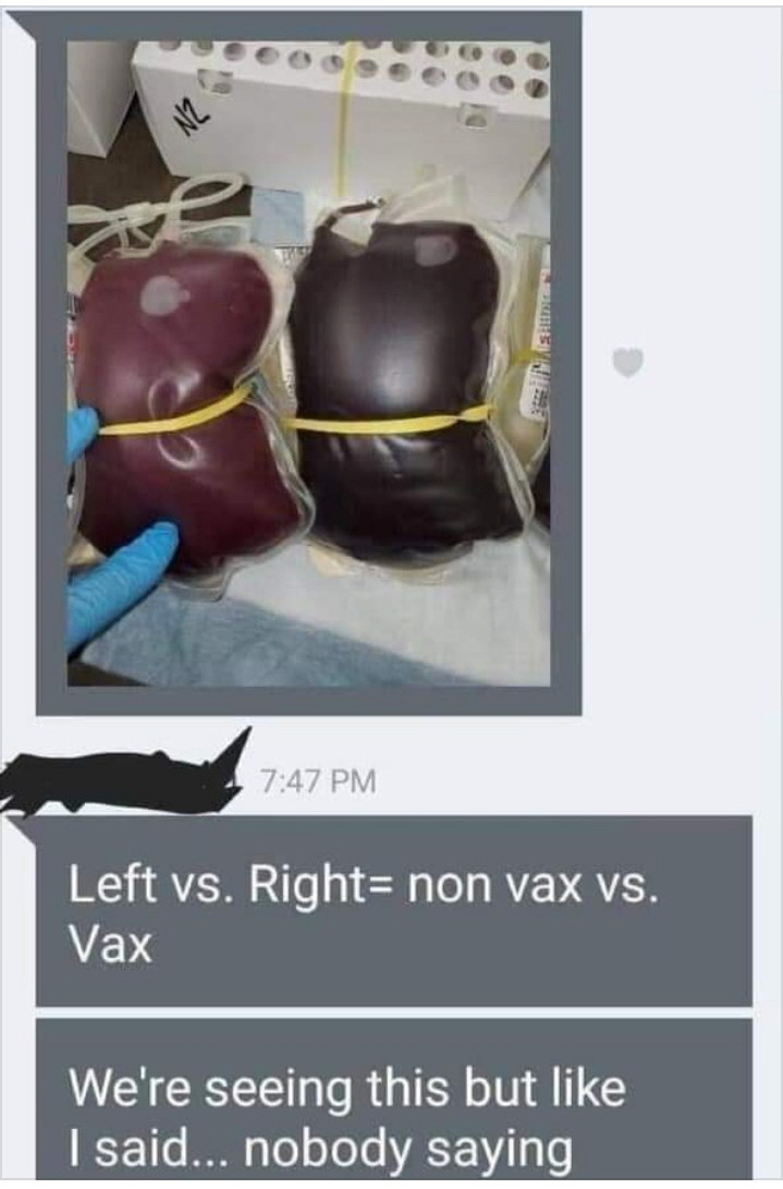 ▲좌측에 있는 혈액이 코로나19 백신 미접종자, 우측에 있는 혈액이 코로나19 백신 접종자의 것이라는 내용이 담긴 사진.
 (출처=온라인 커뮤니티 캡처)