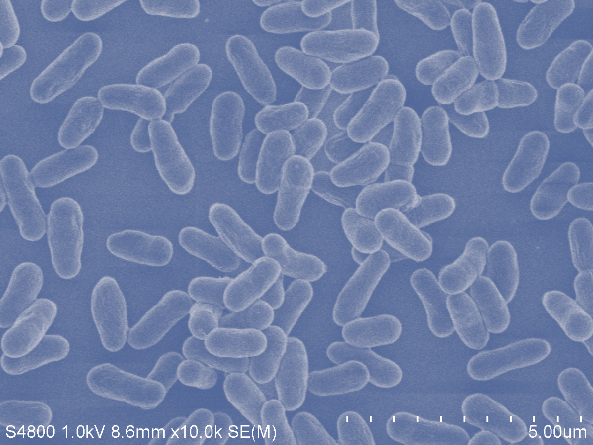 ▲전자현미경으로 본 oraCMU 균주 (자료제공=오라팜)