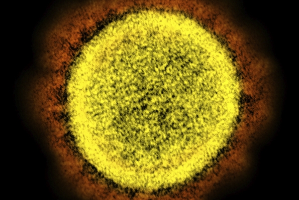 ▲전자현미경으로 촬영한 신종 코로나바이러스 감염증(코로나19) 바이러스. AP뉴시스 
