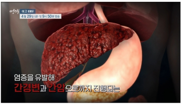 ▲'명의' (사진제공=EBS1)