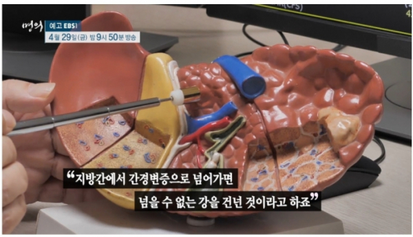 ▲'명의' (사진제공=EBS1)