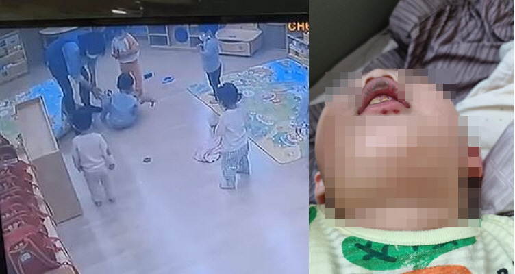 ▲(출처= 보배드림)
