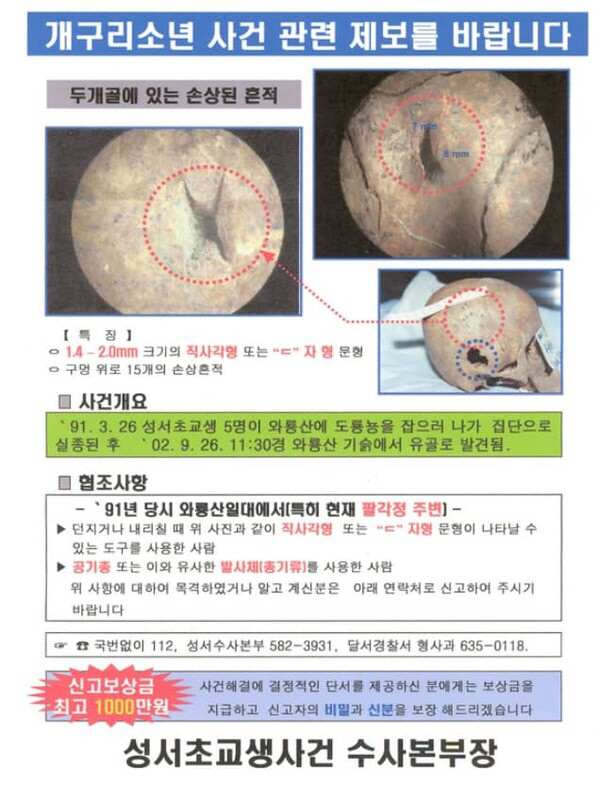 ▲개구리소년 사건 피해 어린이 두개골 사진. (출처=다구 달성경찰서)
