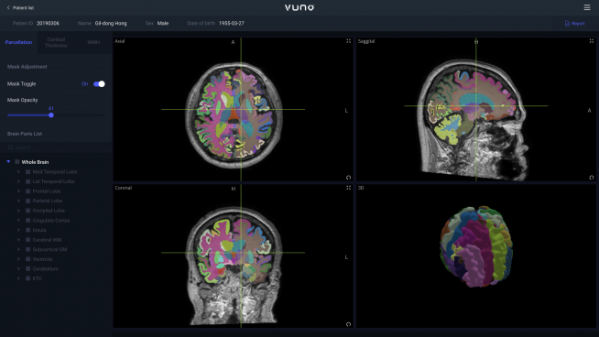 ▲ 인공지능 기반 뇌 정량화 의료기기 뷰노메드 딥브레인(VUNO Med–DeepBrain)