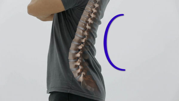 ▲'명의' 정선근 교수(사진제공=EBS1)