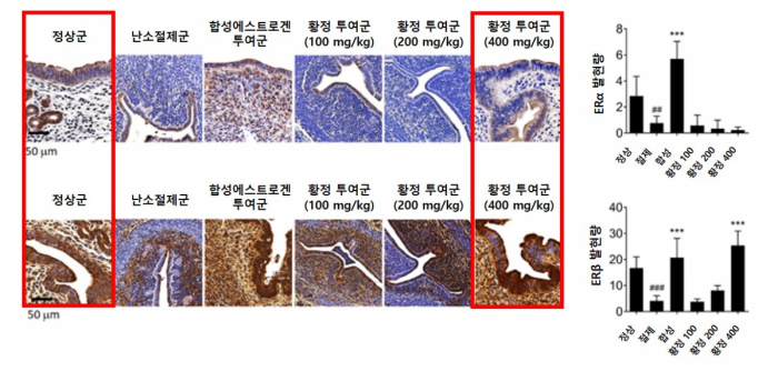 ▲ 황정 투여군의 경우 자궁내막에서 ERα는 억제하고 ERβ의 발현만 증가시켜 정상군과 근접한 치료 효과를 보이는 동시에 자궁내막 과형성 억제 효과를 보였다.(자생한방병원)