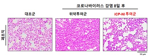 ▲코로나바이러스 (SARS-CoV-2) 감염 실험동물의 손상된 폐 구조가 iCP-NI 투여군에서는 정상수준으로 회복된 모습.