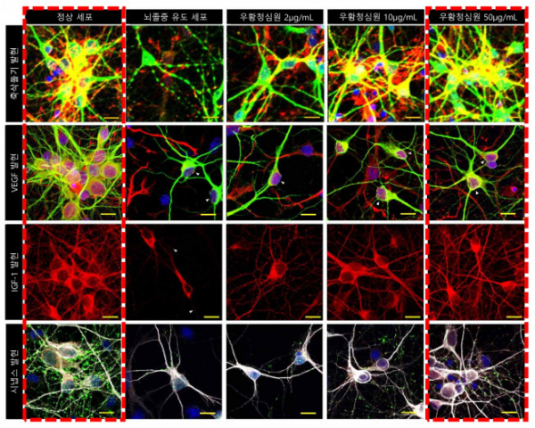 ▲우황청심원 농도별 축삭돌기와 VEGF, IGF-1, 시냅스 발현량 비교. 농도가 높을수록 모든 지표에서 발현이 증가했다. (사진제공=자생한방병원)