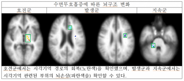 (사진제공=분당서울대병원)