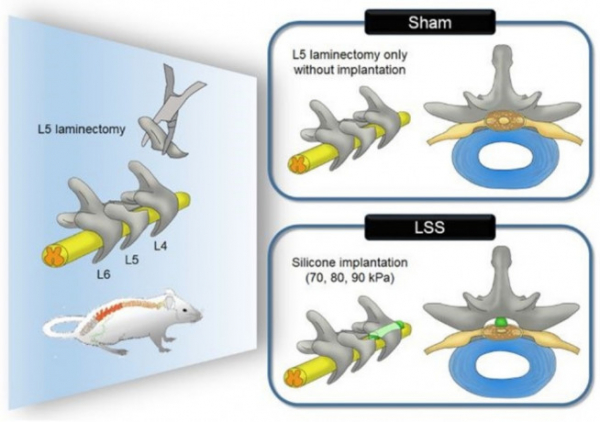 ▲﻿연구팀은 쥐의 척추관에 생체 실리콘을 삽입한 척추관협착증 동물 모델을 제작해 실험을 진행했다. (제공=자생한방병원)
