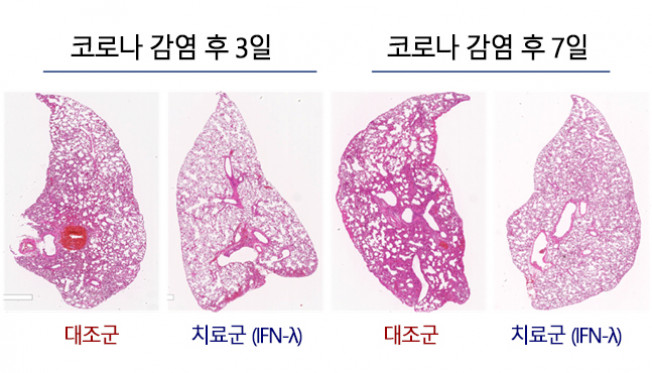 ▲항바이러스 물질 인터페론 람다(IFN-λ)를 비강으로 흡입한 치료군과 대조군의 코로나 감염 동물모델 폐 조직분석 결과 (사진제공=서울대병원)
