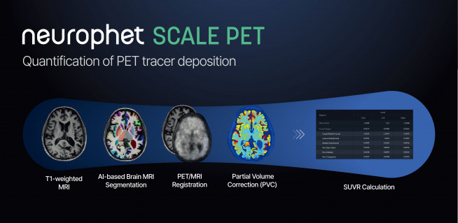 ▲양전자 방출 단층 촬영 영상 자동 분석 소프트웨어 ‘뉴로핏 스케일 펫(Neurophet SCALE PET)’ 이미지 (사진제공=뉴로핏)