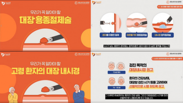 ▲대한소화기내시경학회는 공식 유튜브 채널을 통해 ‘우리가 꼭 알아야 할 대장 용종절제술’, ‘우리가 꼭 알아야 할 고령 환자의 대장 내시경’ 영상을 공개했다. (사진제공=대한소화기내시경학회)