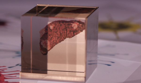 ▲'명의'(사진제공=EBS1)