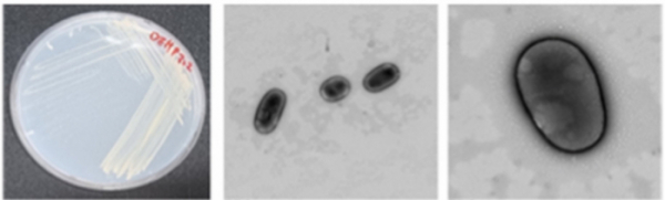 ▲디에틸헥실프탈레이트 분해 미생물 플레이트 사진(왼쪽)과 전자 현미경 사진 (사진제공=국립낙동강생물자원관)