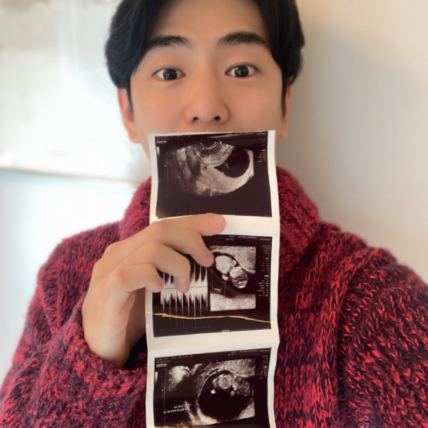 ▲안용준 (사진=안용준 SNS)