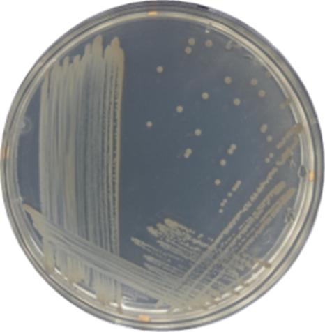 ▲총유기탄소량(TOC) 저감 미생물 혼합균주 5종 중 하나인 로도코커스 조스티CP3-1(Rhodococcus jostii CP3-1) (사진제공=환경부)