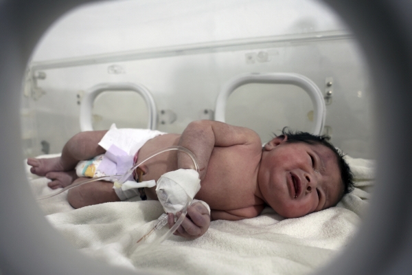 ▲알레포주(州) 아프린 어린이병원에서 치료 받는 신생아 ‘아야’(AP/연합뉴스)
