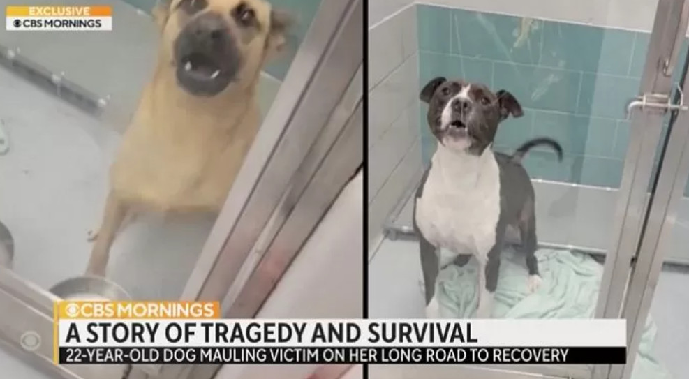 ▲재클린 듀런드를 공격한 두 마리의 개. (출처=CBS Mornings 캡처)