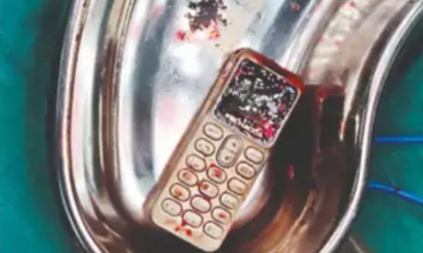 ▲인도의 10대소녀가 삼킨 휴대전화. (출처=타임스 오브 인디아 홈페이지)