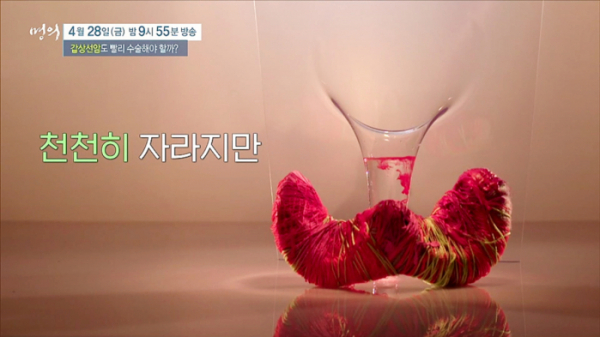 ▲'명의' 갑상선암(사진제공=EBS1)