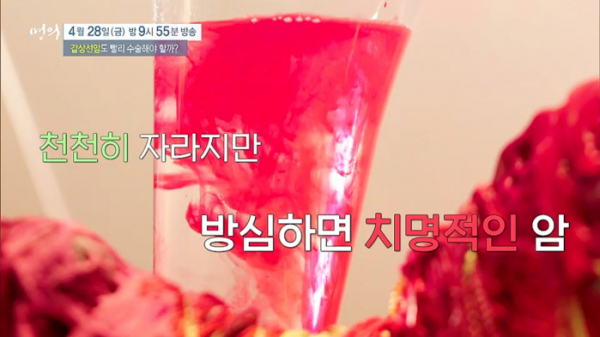 ▲'명의' 갑상선암(사진제공=EBS1)