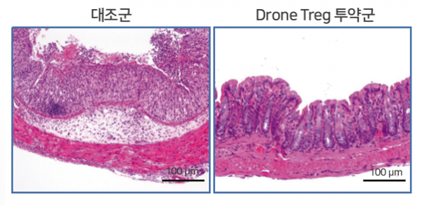 ▲염증 유도에 의해 망가진 대장 조직(왼쪽)과 Drone Treg 세포치료제에 의해 복구된 대장 조직. (자료제공=지아이셀)