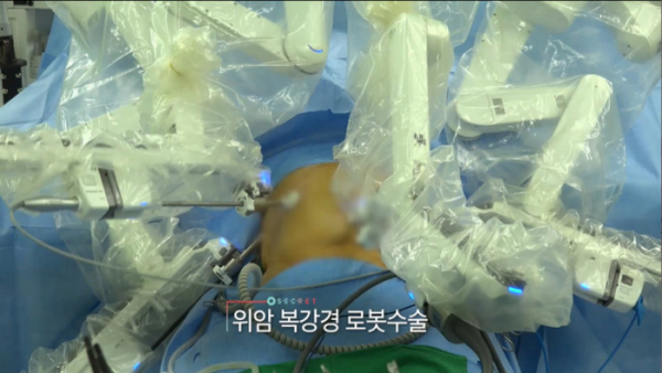 ▲'생로병사의비밀'(사진제공=KBS 1TV)