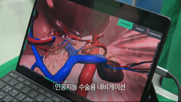 ▲'생로병사의비밀'(사진제공=KBS 1TV)