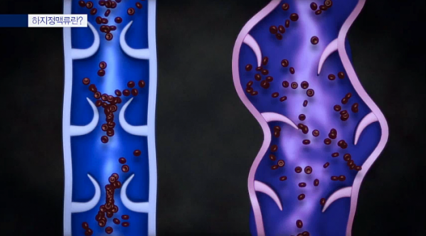 ▲'명의'(사진제공=EBS1)