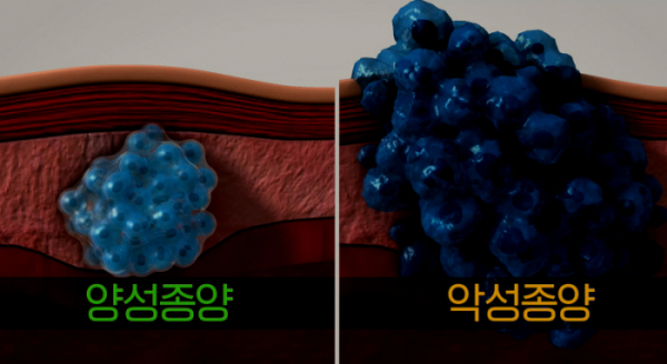 ▲'생로병사의비밀'(사진제공=KBS 1TV)