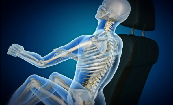 ▲교통사고 충격은 척추에 손상을 야기해 급성 요통을 발생시키는 경우가 잦다.(자생한방병원)