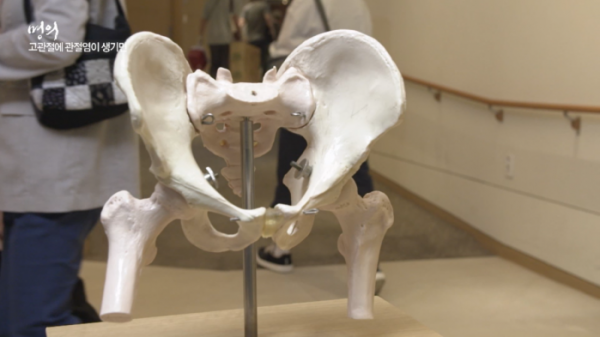 ▲'명의' 고관절(사진제공=EBS1)
