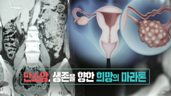 ▲'생로병사의비밀'(사진제공=KBS 1TV)