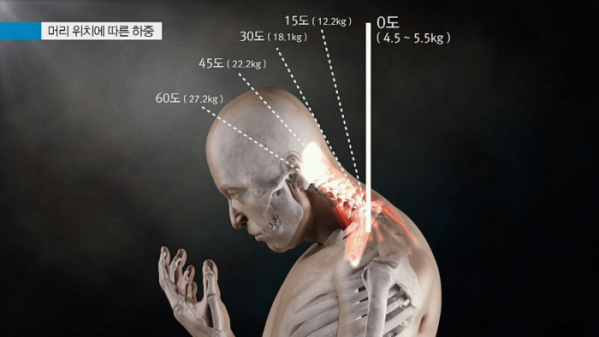 ▲'명의' 경추 (사진제공=EBS1)