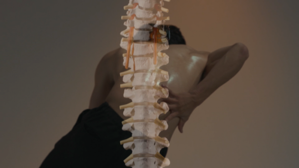 ▲'명의' 허리(사진제공=EBS1)