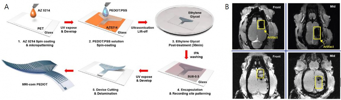 ▲(A)MRI-compatible PEDOT 공정 과정, (B)MRI-compatible PEDOT과 기존 전극의 MRI 촬영 결과. 기존 전극(위쪽 그림)은 이미지 변성으로 인해 결과물 확인이 어려웠던 반면 MRI-compatible PEDOT(아래쪽 그림)의 경우 이미지 변성 없이 안정적으로 결과물을 보였다. (사진제공=연세대학교 의료원)