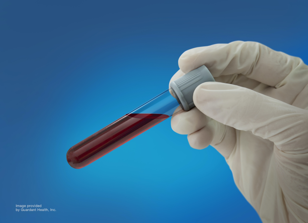 ▲가던트헬스의 혈액검사 (사진제공=가던트헬스)