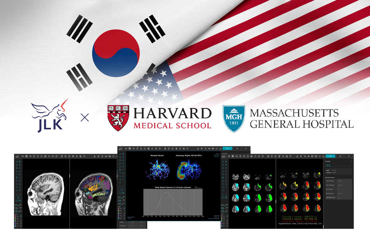 (사진제공=제이엘케이)
