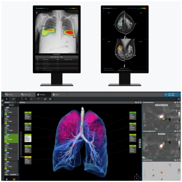 ▲루닛 흉부 엑스레이 AI 영상분석 솔루션 루닛 인사이트 CXR·루닛 인사이트 MMG와 코어라인소프트의 흉부질환 동시진단 솔루션 AVIEW LCS PLUS. (사진제공=루닛, 코어라인소프트)