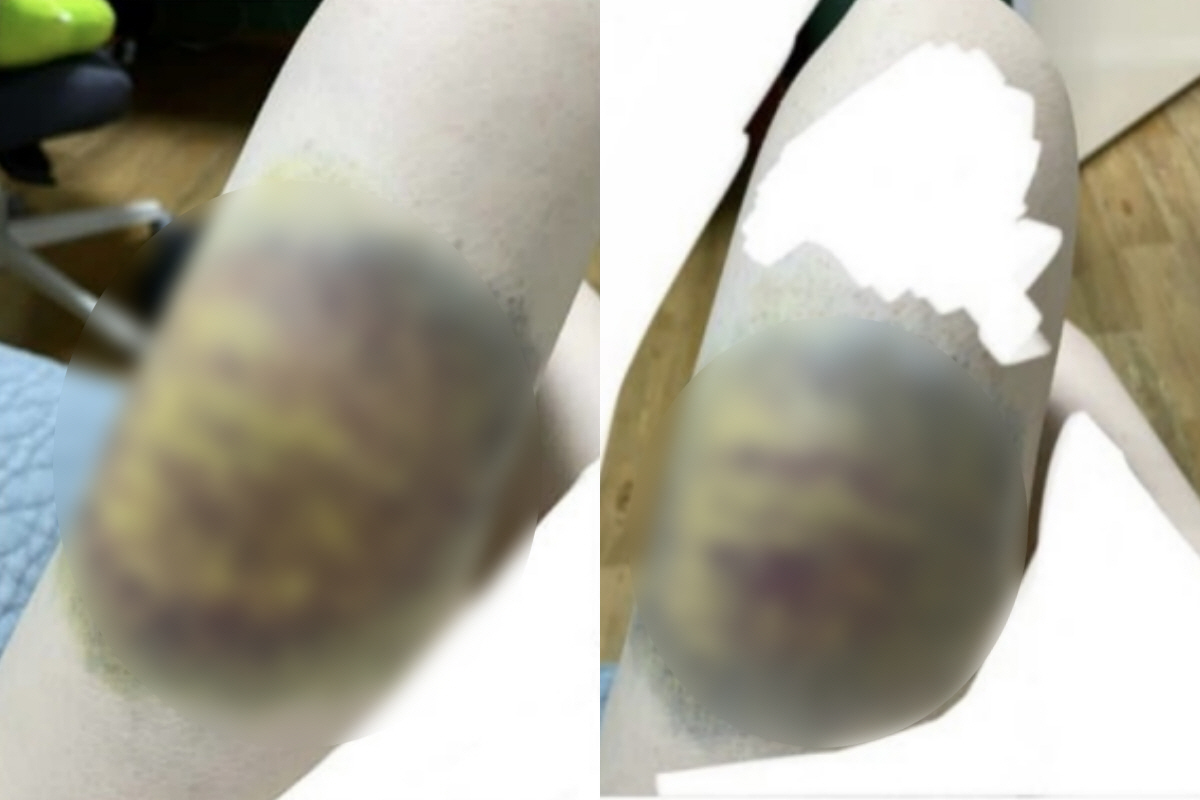 ▲(출처=온라인 커뮤니티)