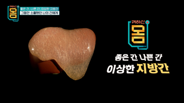 ▲'귀하신몸'(사진제공=EBS1)