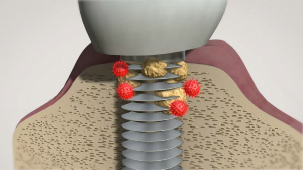 ▲'생로병사의비밀'(사진제공=KBS 1TV)