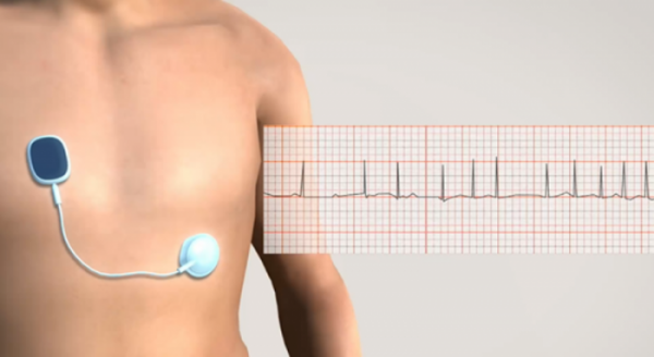 ▲'생로병사의 비밀‘(사진제공=KBS 1TV)