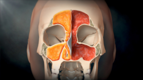 ▲'명의' 코 질환(사진제공=EBS1)