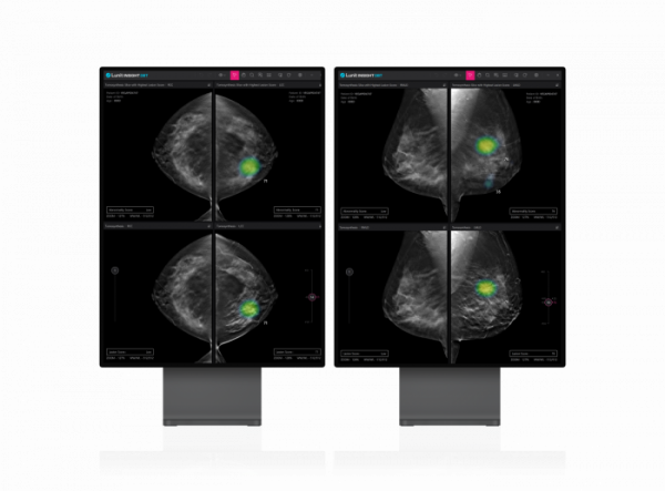 ▲Lunit INSIGHT DBT (사진제공=루닛)