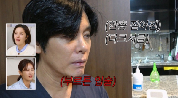 ▲'조선의사랑꾼'(사진제공=TV조선)