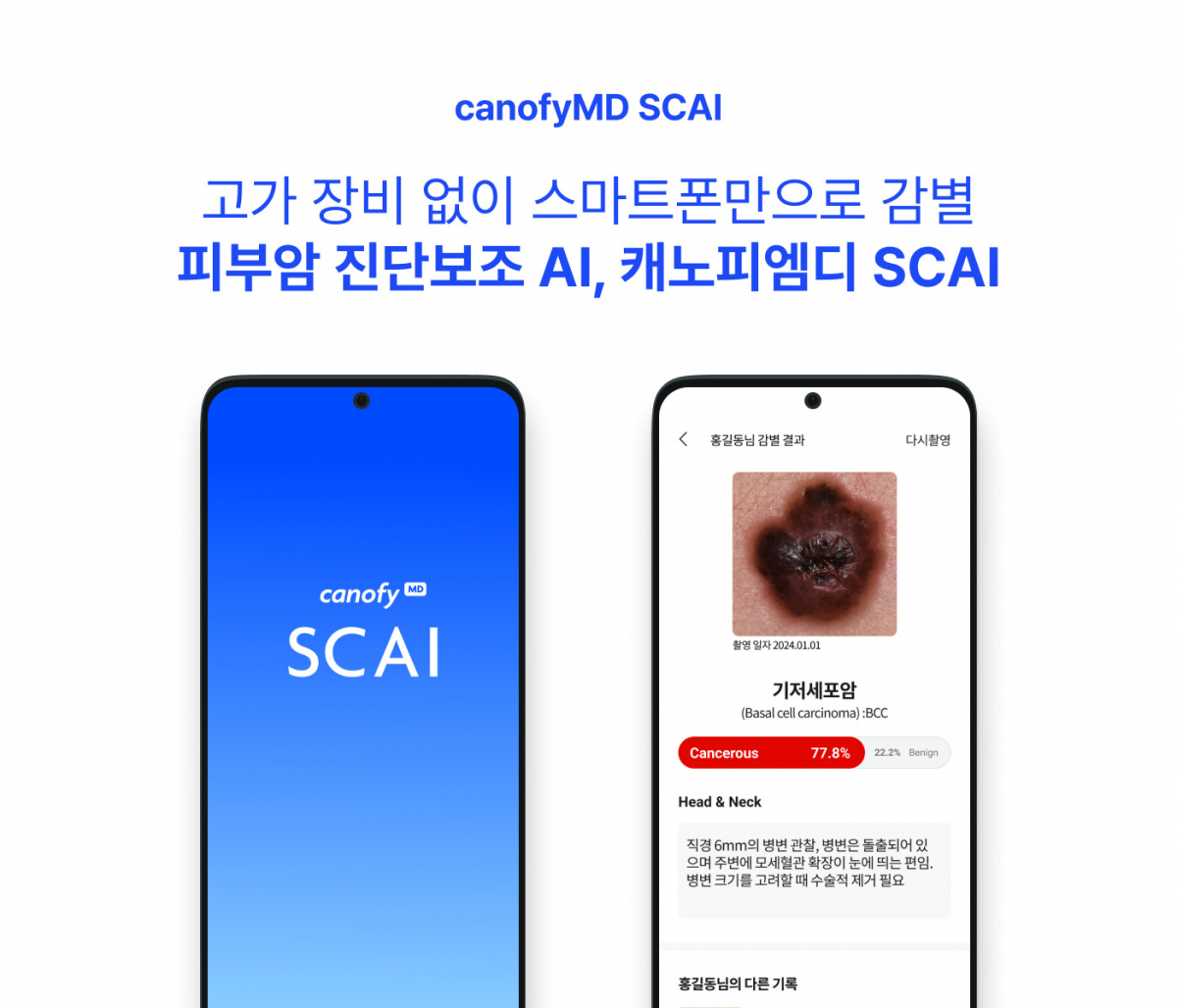▲캐노피엠디_SCAI_서비스 화면. (사진제공=라이프시맨틱스)