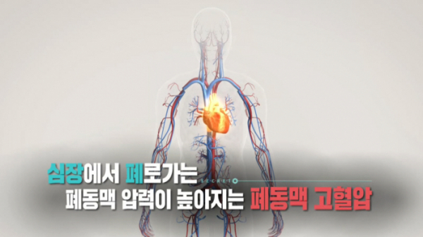 ▲'생로병사의비밀' (사진제공=KBS 1TV)