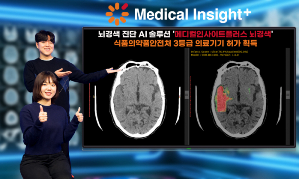 ▲SK C&C가 뇌경색 진단 AI 솔루션 ‘메디컬인사이트플러스 뇌경색’이 식품의약안전처로부터 3등급 의료기기 품목 허가를 받았다고 22일 밝혔다.  (사진=SK C&C)